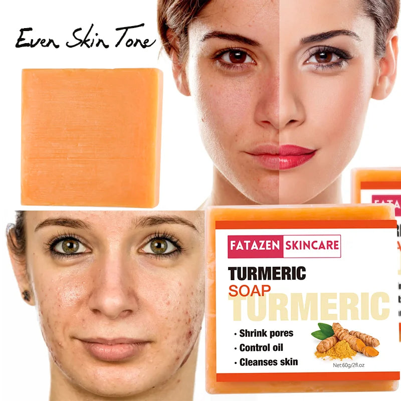 Private Label Natural Organic Deep Cleansing Bath Toilet Soaps Handmade Skin Care Products Whitening Anti Acne Turmeric Bar Soap