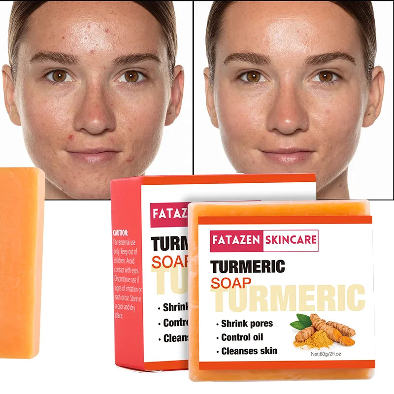 Private Label Natural Organic Deep Cleansing Bath Toilet Soaps Handmade Skin Care Products Whitening Anti Acne Turmeric Bar Soap