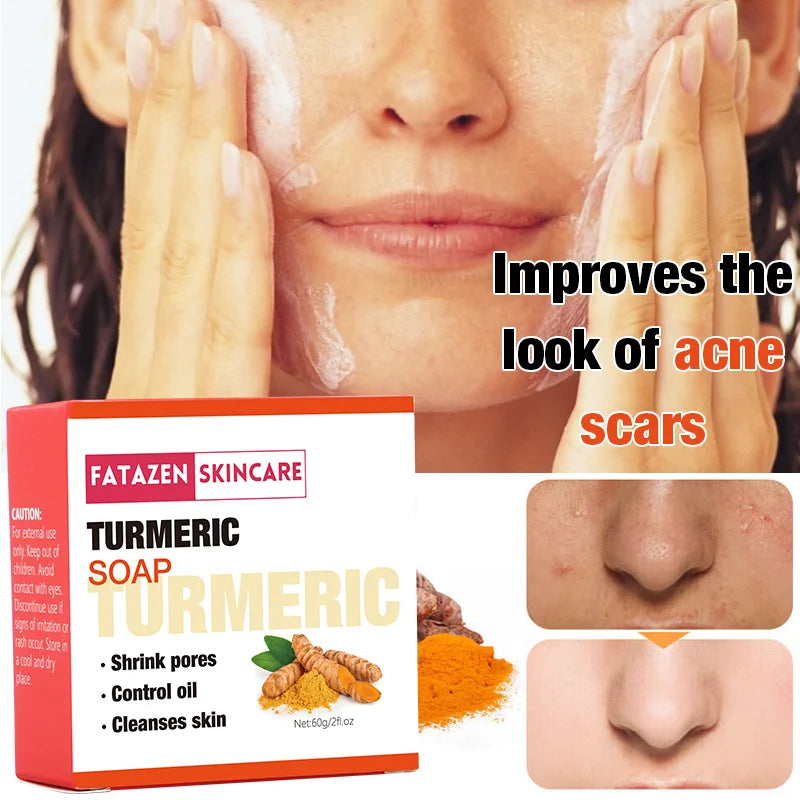 Private Label Natural Organic Deep Cleansing Bath Toilet Soaps Handmade Skin Care Products Whitening Anti Acne Turmeric Bar Soap