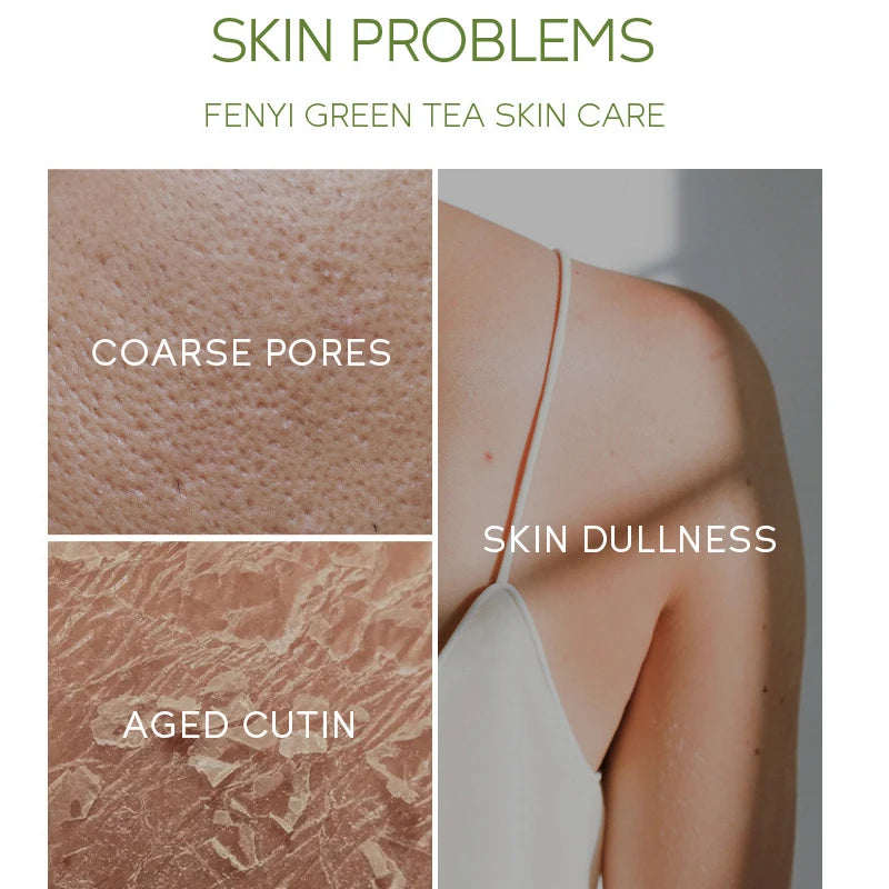 Body Exfoliating Body Scrub Exfoliates Deeply Cleanses Smooths Whitening Skin Remove Dead Skin Body Face Scrub Exfoliating