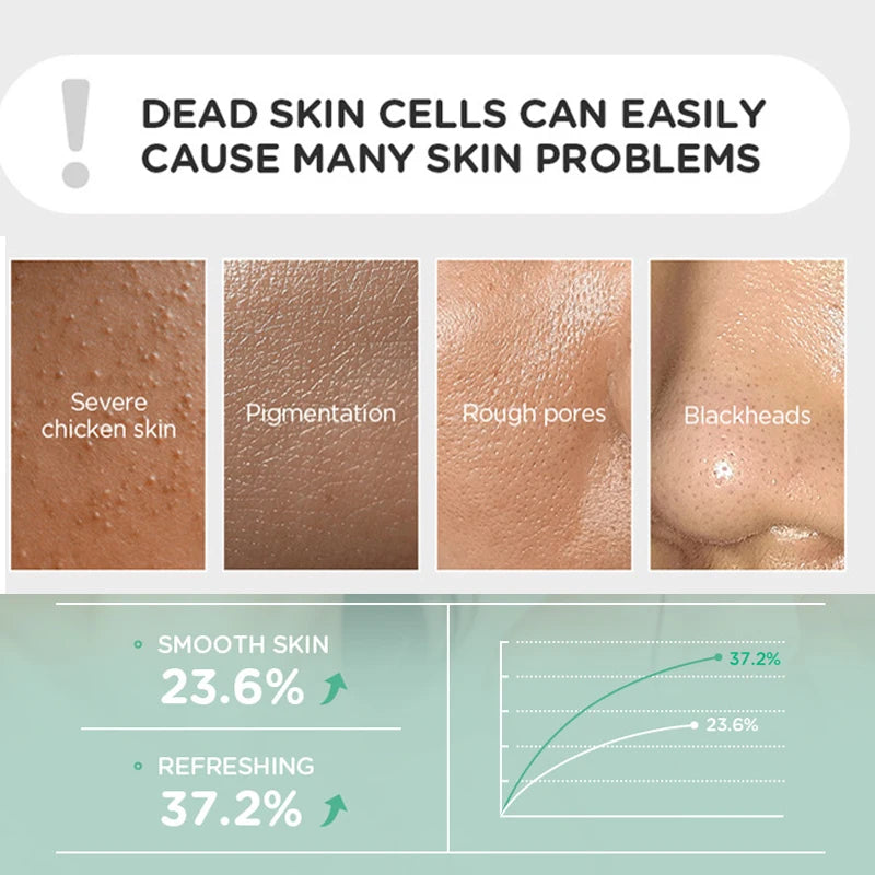 Body Exfoliating Body Scrub Exfoliates Deeply Cleanses Smooths Whitening Skin Remove Dead Skin Body Face Scrub Exfoliating