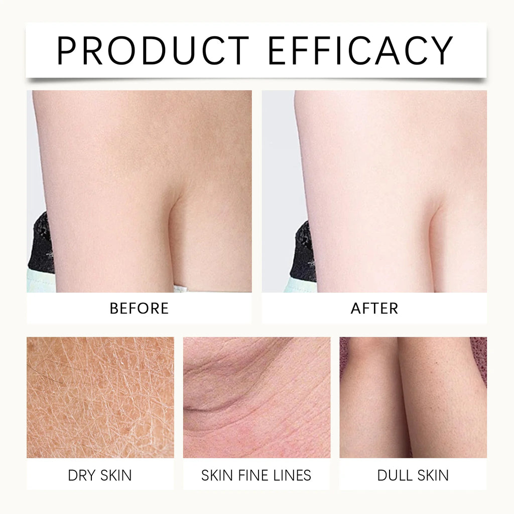 Firming Skin Body Lotion Improve Sagging Skin Increase Elasticity Smooth Drying Roughness Reduce Pigmentation Lightening Cream