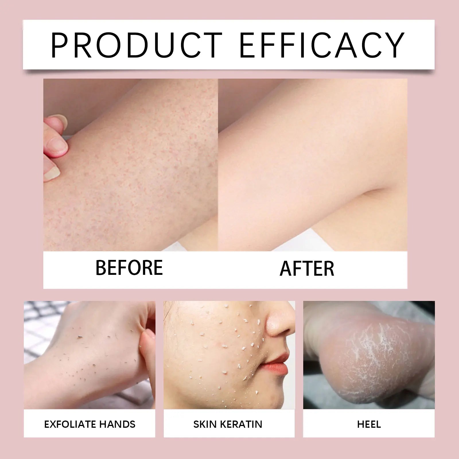 Christmas Bath Bombs Gift Set Organic Bubble Bath Exfoliating Relax Stress Aromatherapy Gentle Cleaning Smoothing Body Skin Care